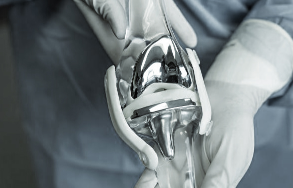 protesi totale ginocchio bergamo