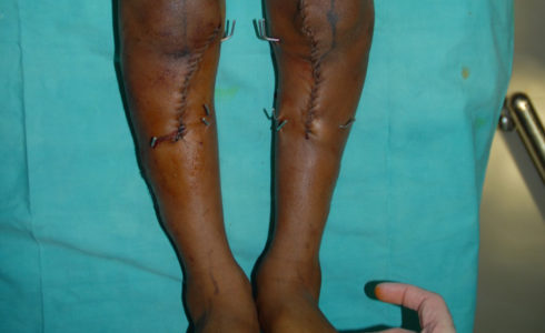 ortopedico anca ginocchio